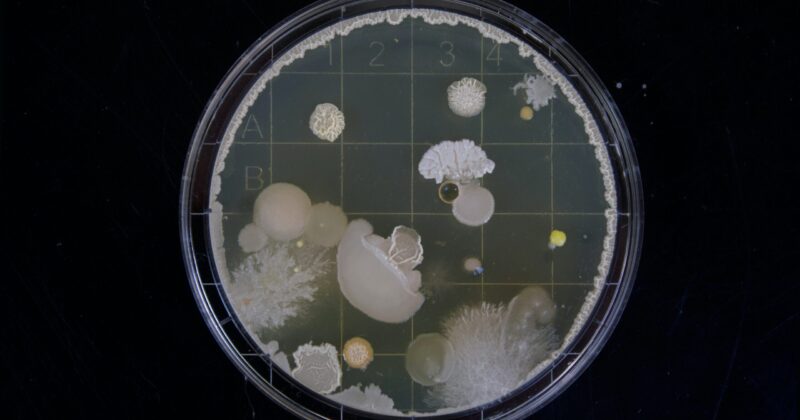 Flesh-Eating Bacteria Infections Are On The Rise In The US